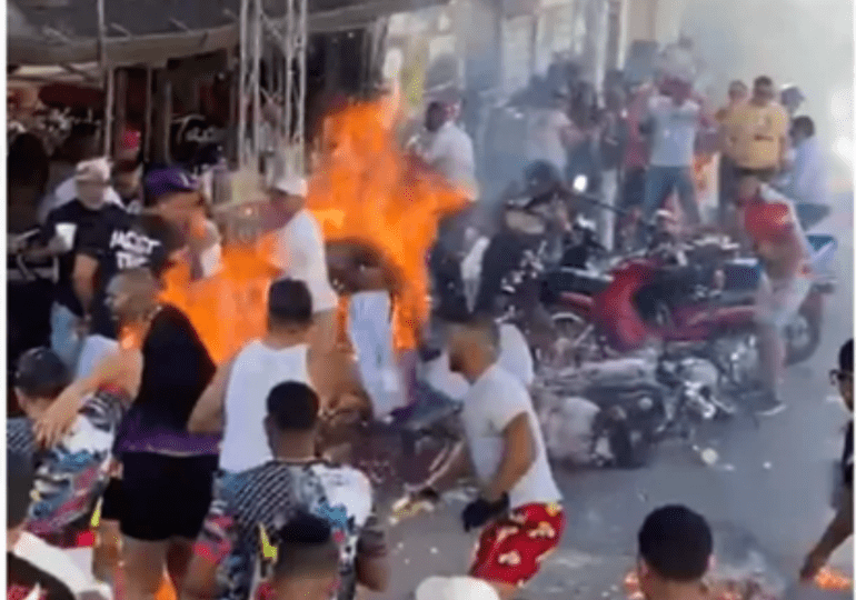 SNS informa fallece otros de los niños ingresados en Santiago por quemaduras en Carnaval de Salcedo