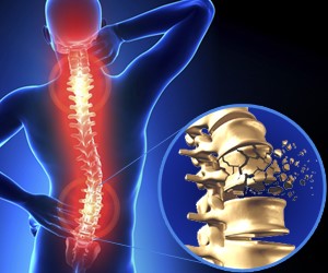 Tratamiento con células madre de los pacientes pueden ayudar a tratar las lesiones de la médula espinal