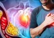 Secuelas del Covid-19 podrían estar causando infartos, según Sociedad de Cardiología