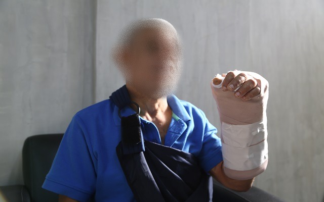 Paciente con buen diagnóstico tras reconstrucción de mano en el Gautier