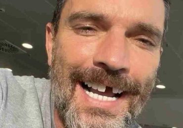 Julián Gil pierde un diente mientras grababa el reality show "La Isla: Desafío Extremo"