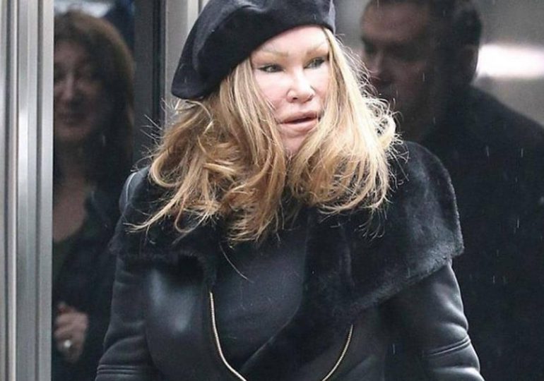 Muere Jocelyn Wildenstein, conocida como la "mujer gato"