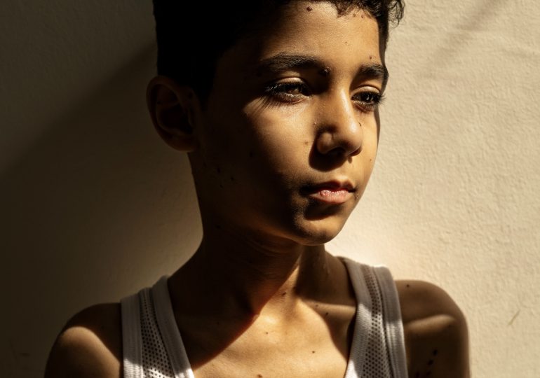 Una foto sobre las secuelas de la guerra en los niños gazatíes gana el World Press Photo global