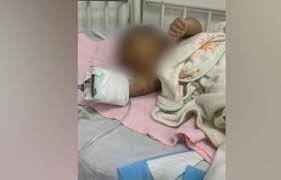 Bebé de tres meses presuntamente agredida por su madre ya se encuentra bajo el cuidado de su padre