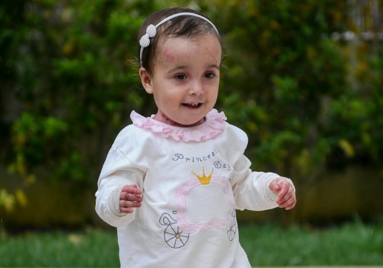 Día Internacional de la Piel de Mariposa