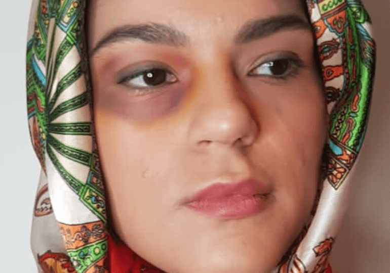 Violeta Ramírez y una imagen que incomoda para despertar conciencias