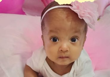 Solicitan ayuda para cirugía de implantes cocleares a bebé prematura