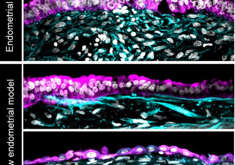 Logran implantar con éxito un embrión en un endometrio artificial