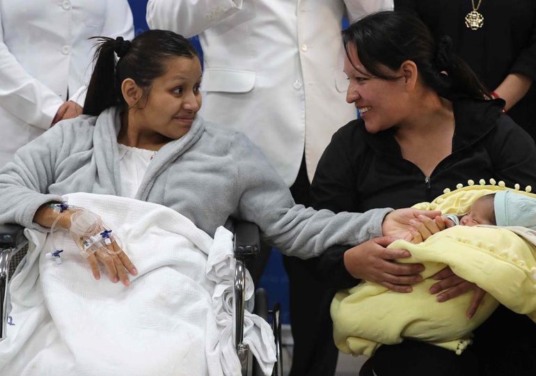 Video | Perú registra cuarto nacimiento en el mundo de un embarazo ectópico con bebé en el hígado